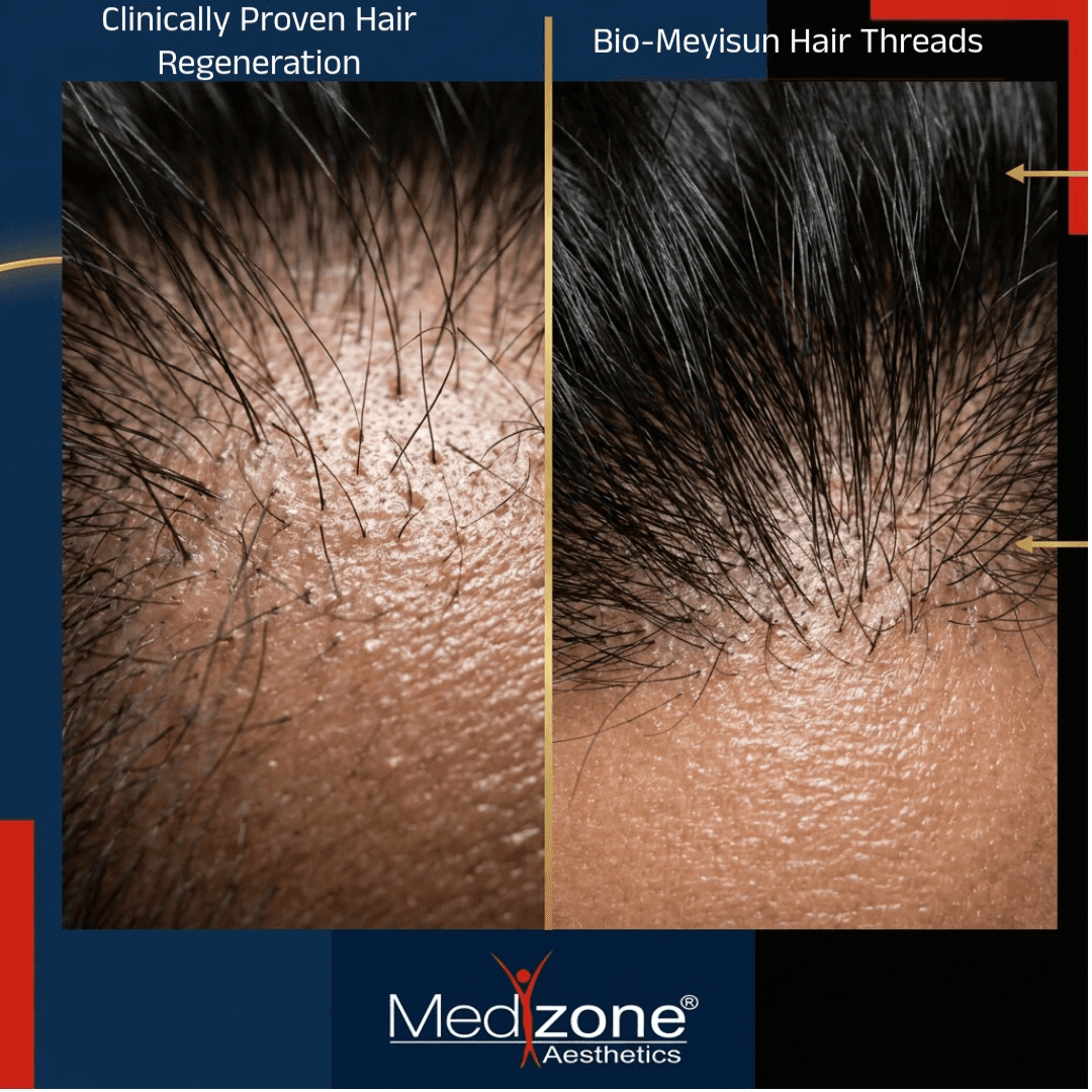 Before and after hair restoration comparison
