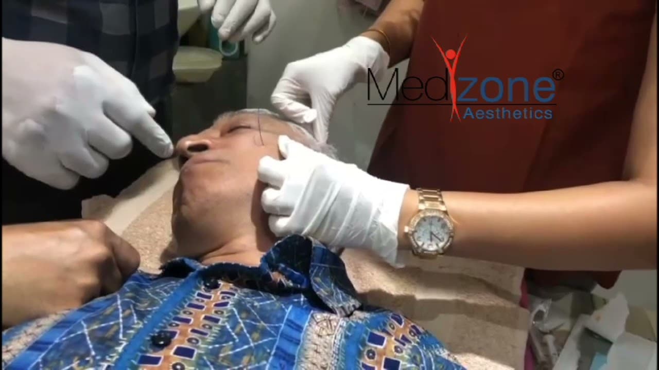 Double Needle